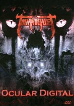 Tourniquet : Ocular Digital